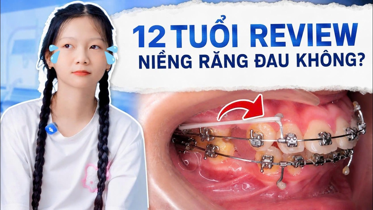 Nha khoa Lạc Việt Intech - Trung tâm trồng răng implant và chỉnh nha chuyên sâu
