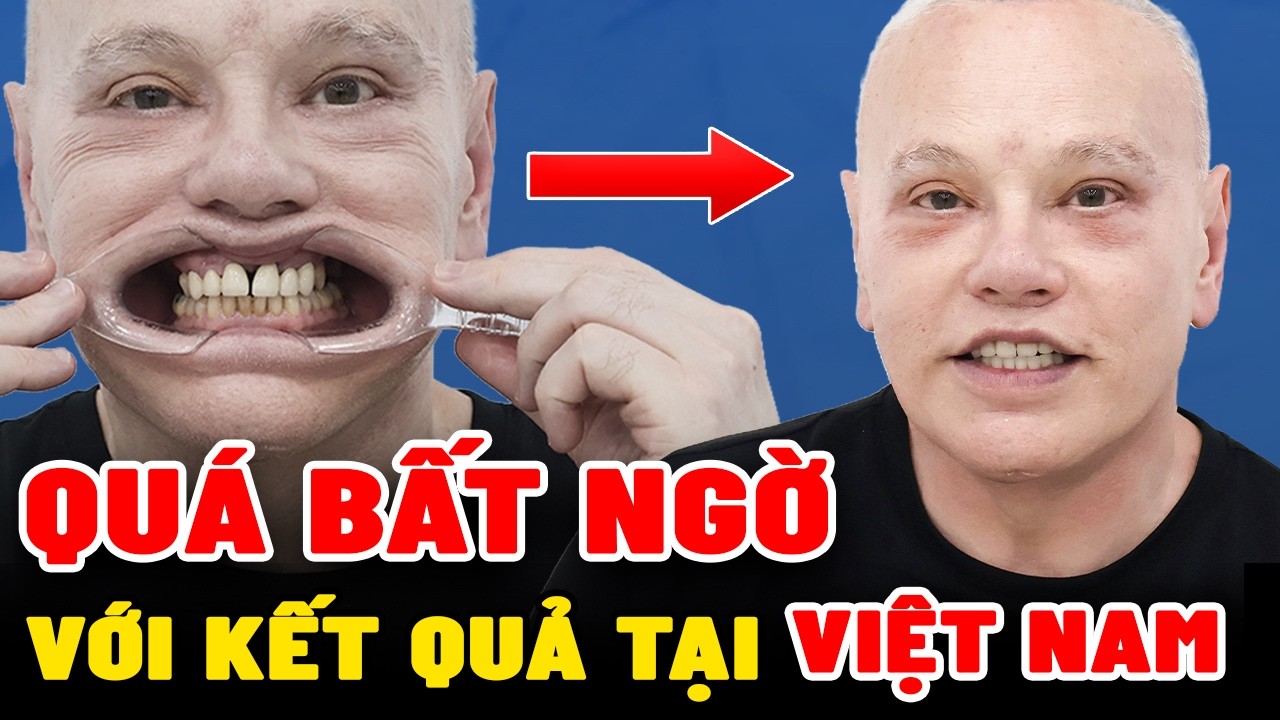 Nha khoa Lạc Việt Intech - Trung tâm trồng răng implant và chỉnh nha chuyên sâu