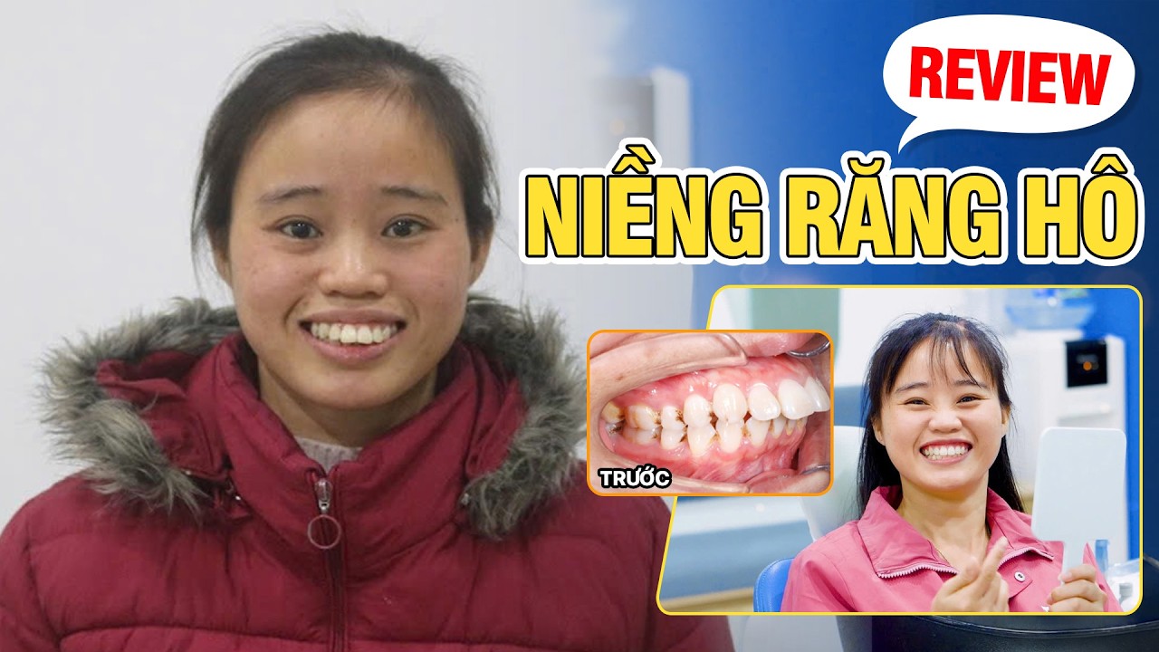 Nha khoa Lạc Việt Intech - Trung tâm trồng răng implant và chỉnh nha chuyên sâu