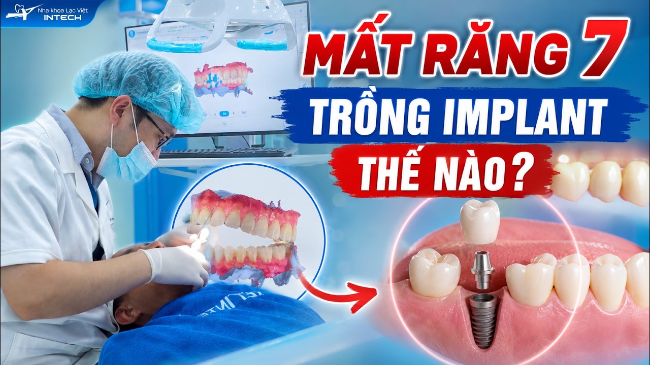 Nha khoa Lạc Việt Intech - Trung tâm trồng răng implant và chỉnh nha chuyên sâu