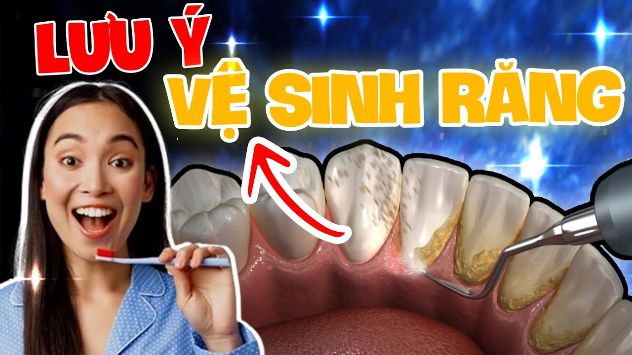 VỆ SINH RĂNG MIỆNG KHI NIỀNG - 4 LƯU Ý ĐẶC BIỆT QUAN TRỌNG 