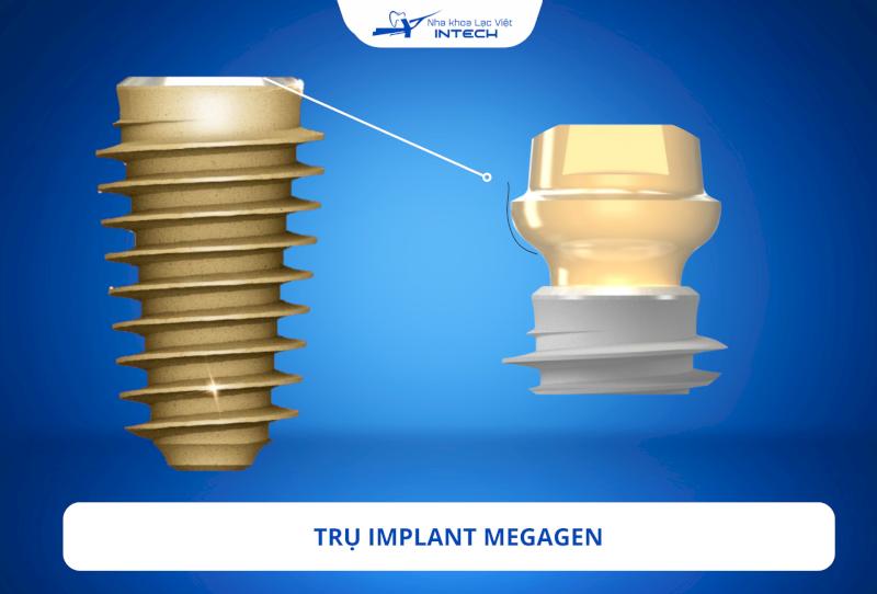 Phần cổ trụ được thiết kế hạn chế xâm lấn nhằm giảm nguy cơ tiêu xương hàm