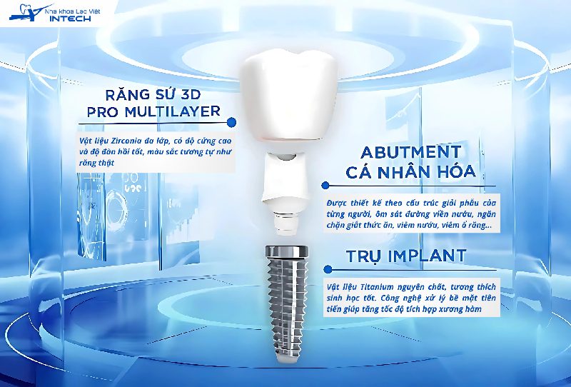 Một răng Implant tốt cần đảm bảo cả ba bộ phận đều được làm từ vật liệu an toàn, được xử lý bằng các công nghệ tiên tiến