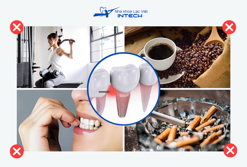 Cô chú/anh chị nên điều chỉnh một số thói quen hàng ngày để tránh gây ảnh hưởng đến Implant vừa cấy ghép