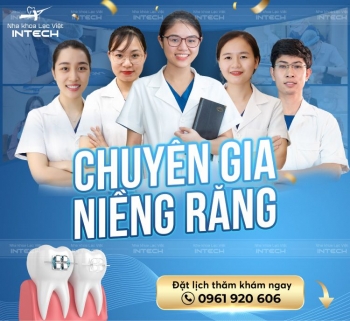 Niềng răng trẻ em bao nhiêu tiền 2022 phụ huynh tham khảo