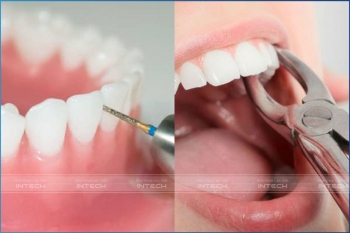 Trồng răng Implant giá bao nhiêu tiền? Bảng giá trồng răng mới 2023