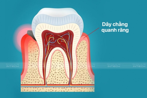 Cơ chế hoạt động các loại mắc cài trong niềng răng nên biết