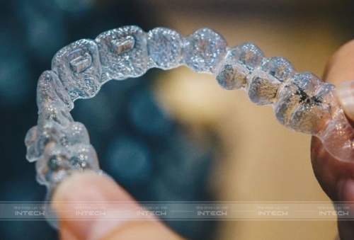 Niềng răng Invisalign trả góp giúp khách hàng nhẹ gánh chi phí