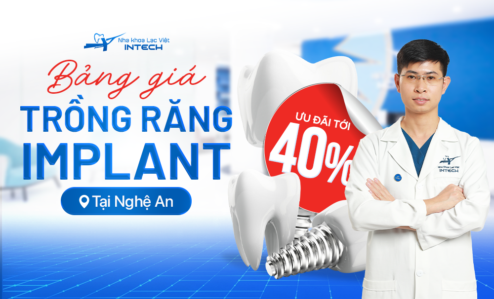 CHƯƠNG TRÌNH KHUYẾN MÃI ĐẶC BIỆT TẠI NGHỆ AN – GIẢM ĐẾN 40% CHI PHÍ TRỒNG RĂNG IMPLANT