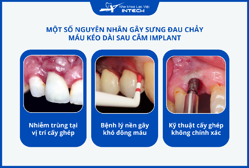 Nguyên nhân gây sưng đau chảy máu kéo dài có thể do thao tác bác sĩ thô bạo, môi trường phẫu thuật không vô trùng hoặc tiền sử bệnh lý toàn thân của cô chú/anh chị