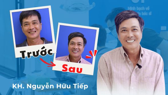 Cả hàm răng lung lay, ăn uống đau nhức: Chú Nguyễn Hữu Tiếp tìm lại niềm vui tuổi già nhờ trồng răng Implant