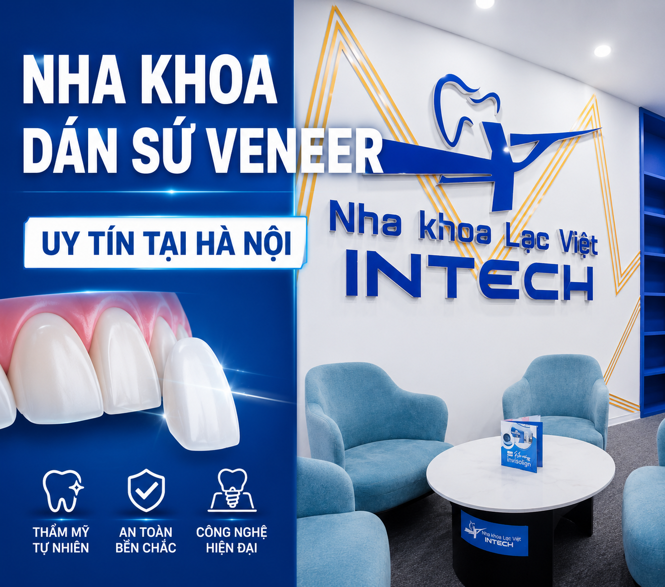 Top 11 nha khoa dán sứ Veneer uy tín tại Hà Nội được nhiều khách hàng lựa chọn