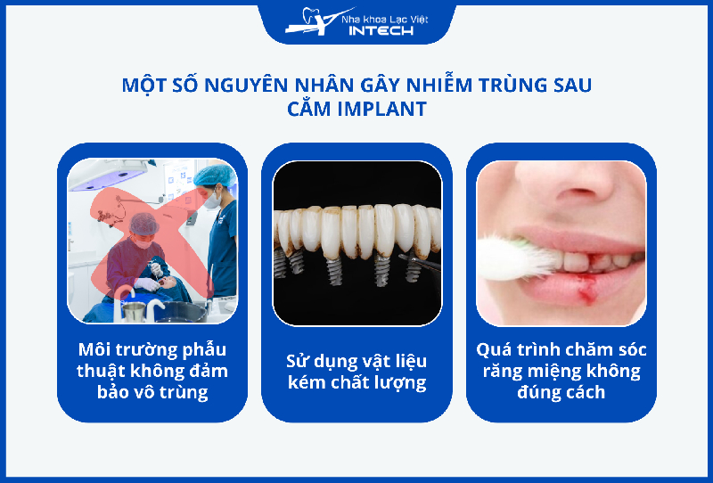 Nhiễm trùng sau cắm Implant có thể xảy ra do môi trường cấy ghép, chất lượng Implant không đạt chuẩn hoặc do chăm sóc sai cách