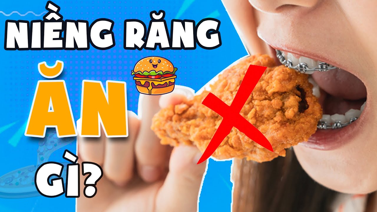 Niềng Răng Nên Ăn Gì? 05 Nhóm Thực Phẩm Siêu Ngon Mà Không Lo Bong Mắc Cài
