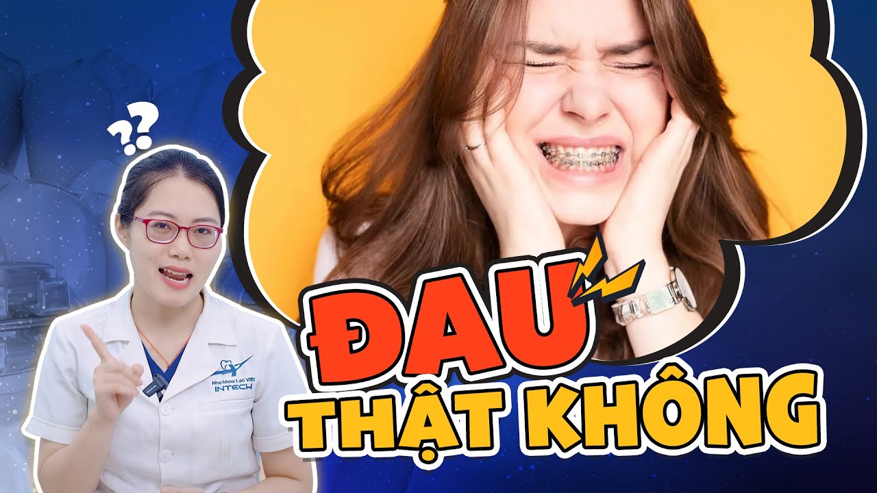 Niềng răng có đau không? Giải mã 5 giai đoạn niềng răng gây đau và cách giảm đau hiệu quả