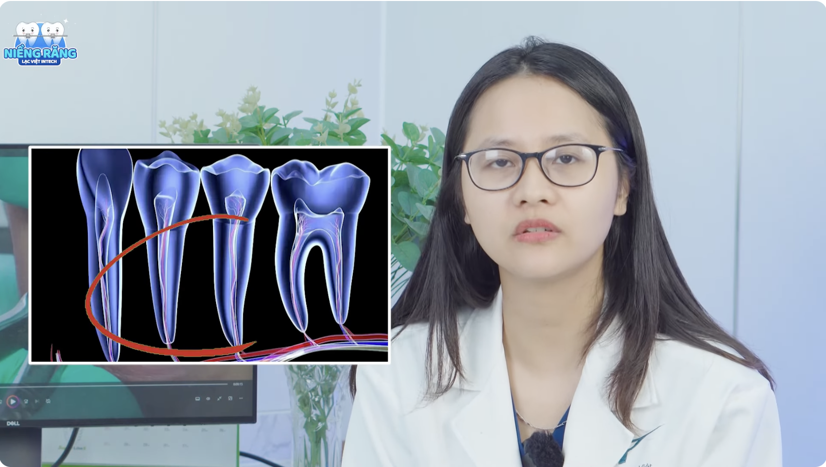 nhổ răng khi niềng có đau không