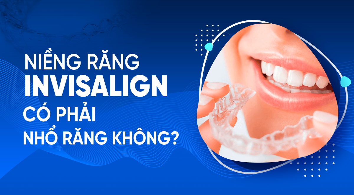 Niềng răng Invisalign có phải nhổ răng không?