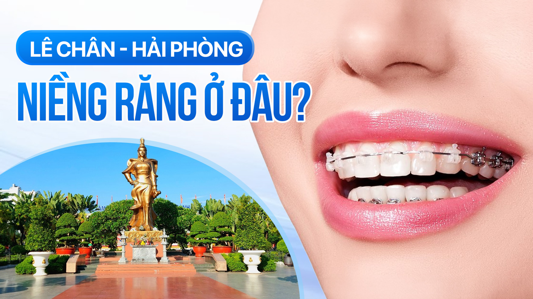 Địa chỉ niềng răng Lê Chân, Hải Phòng: Review chi tiết và Bảng giá 2026