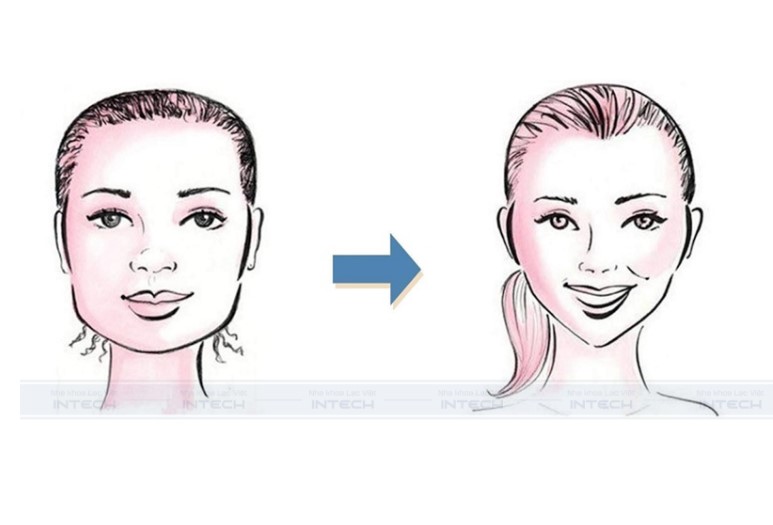 góc nghiêng trước và sau khi niềng răng
