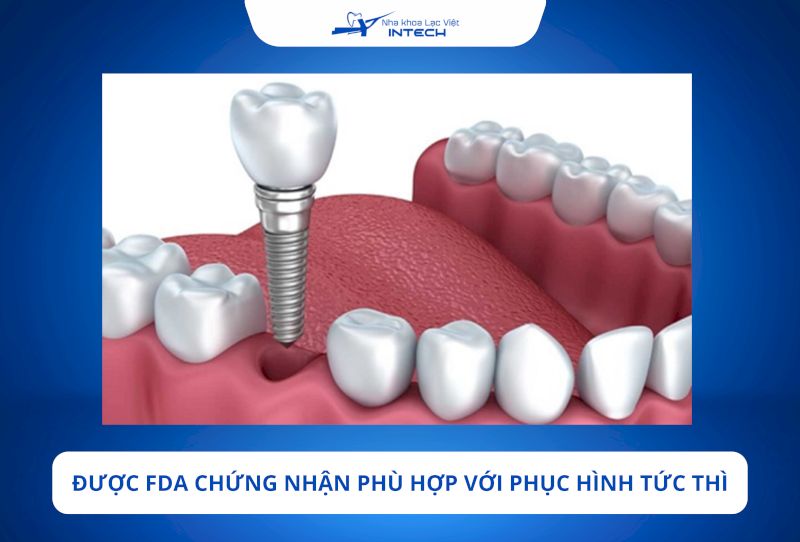 Trụ Implant Nobel Biocare là dòng trụ đầu tiên được FDA chứng nhận cho phục hình tức thì