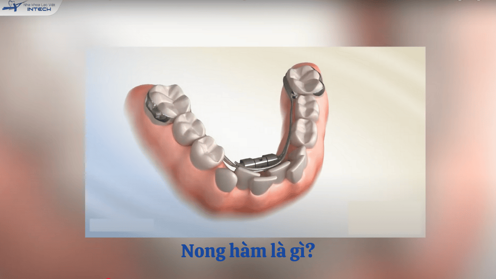 Nong hàm có đau không?