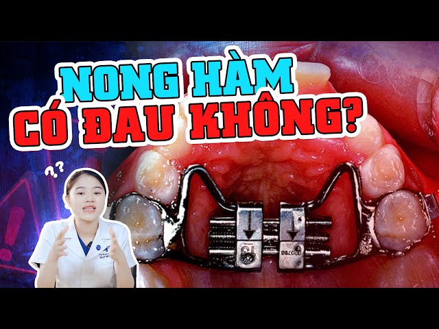 Nong Hàm Có Đau Không? 3 Giai Đoạn Đau Nhất Và Cách Giảm Đau Tại Nhà Hiệu Quả