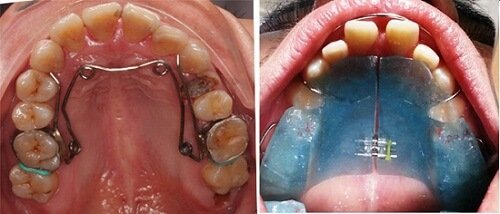 NONG HÀM LÀ GÌ? TRƯỜNG HỢP NÀO CẦN THỰC HIỆN