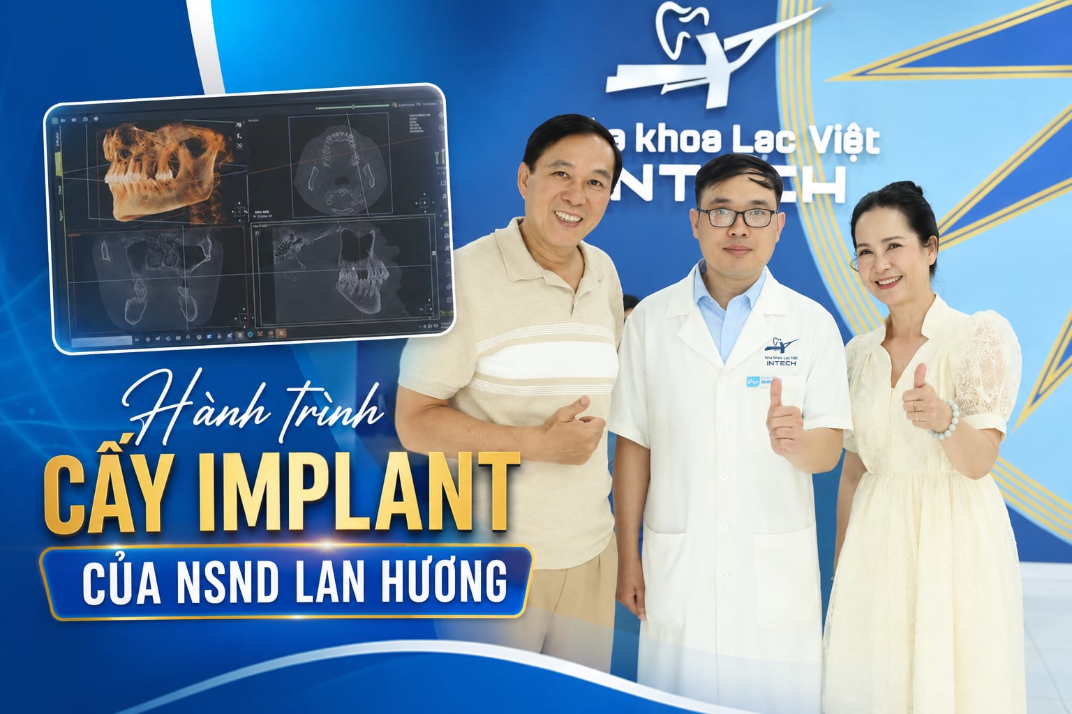 Hành Trình Cấy Ghép Implant Của NSND Lan Hương: Minh Bạch Là Nền Tảng Của Sự An Tâm