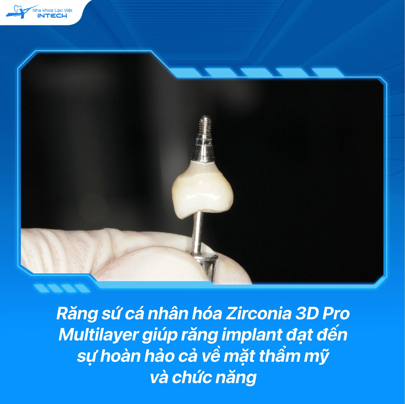 Răng sứ được thiết kế theo dữ liệu hàm của mỗi người, đạt độ chính xác gần như tuyệt đối