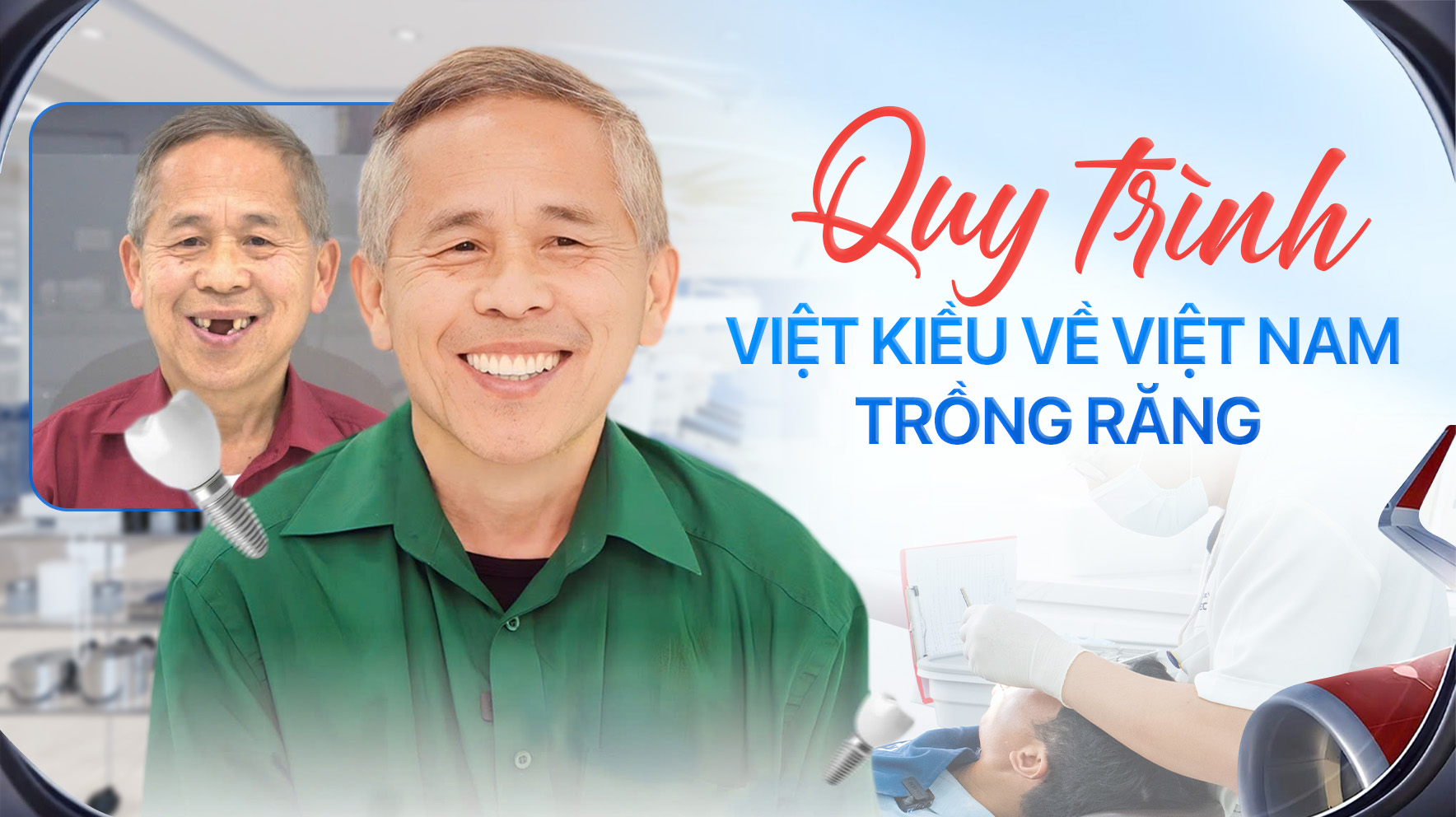 Quy Trình Việt Kiều Về Việt Nam Làm Răng: 2 Phương Án Tối Ưu Thời Gian & Chi Phí