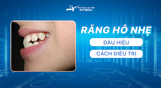 Răng hô nhẹ 