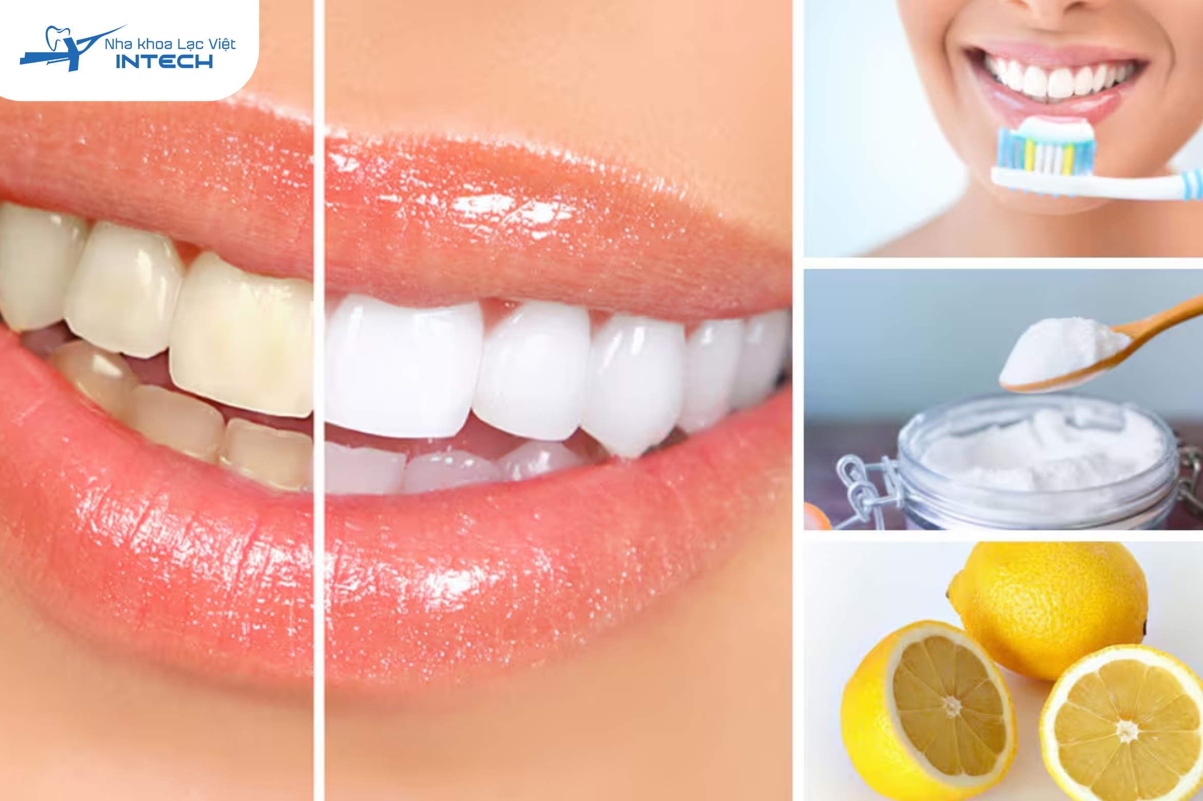Các phương pháp tại nhà tiện lợi, chi phí thấp nhưng hiệu quả thường không cao và cần sự kiên trì