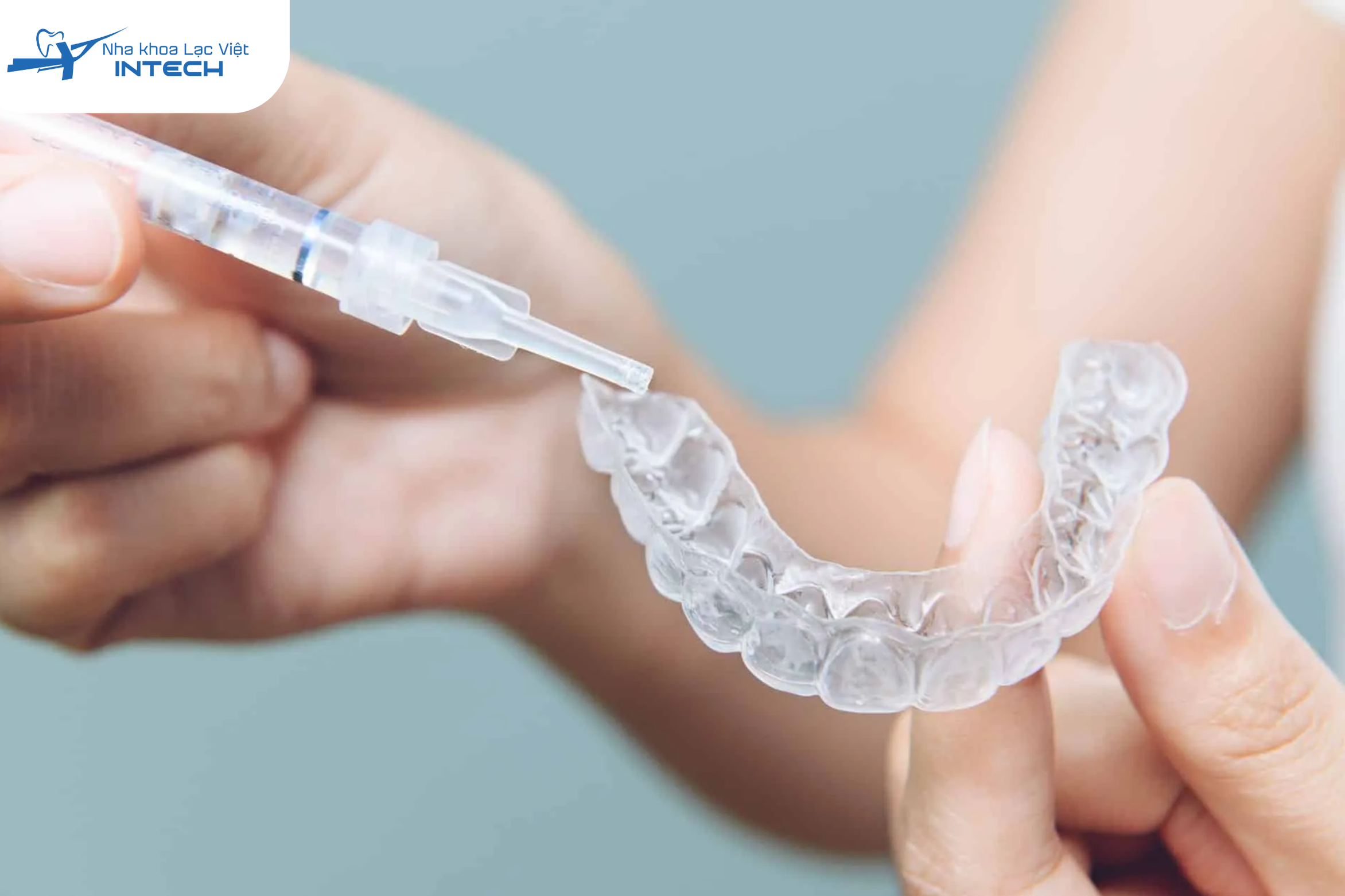 Bác sĩ sẽ lấy dấu răng của cô chú anh chị để thiết kế một cặp máng nhựa trong suốt, vừa khít hoàn hảo với cung hàm.