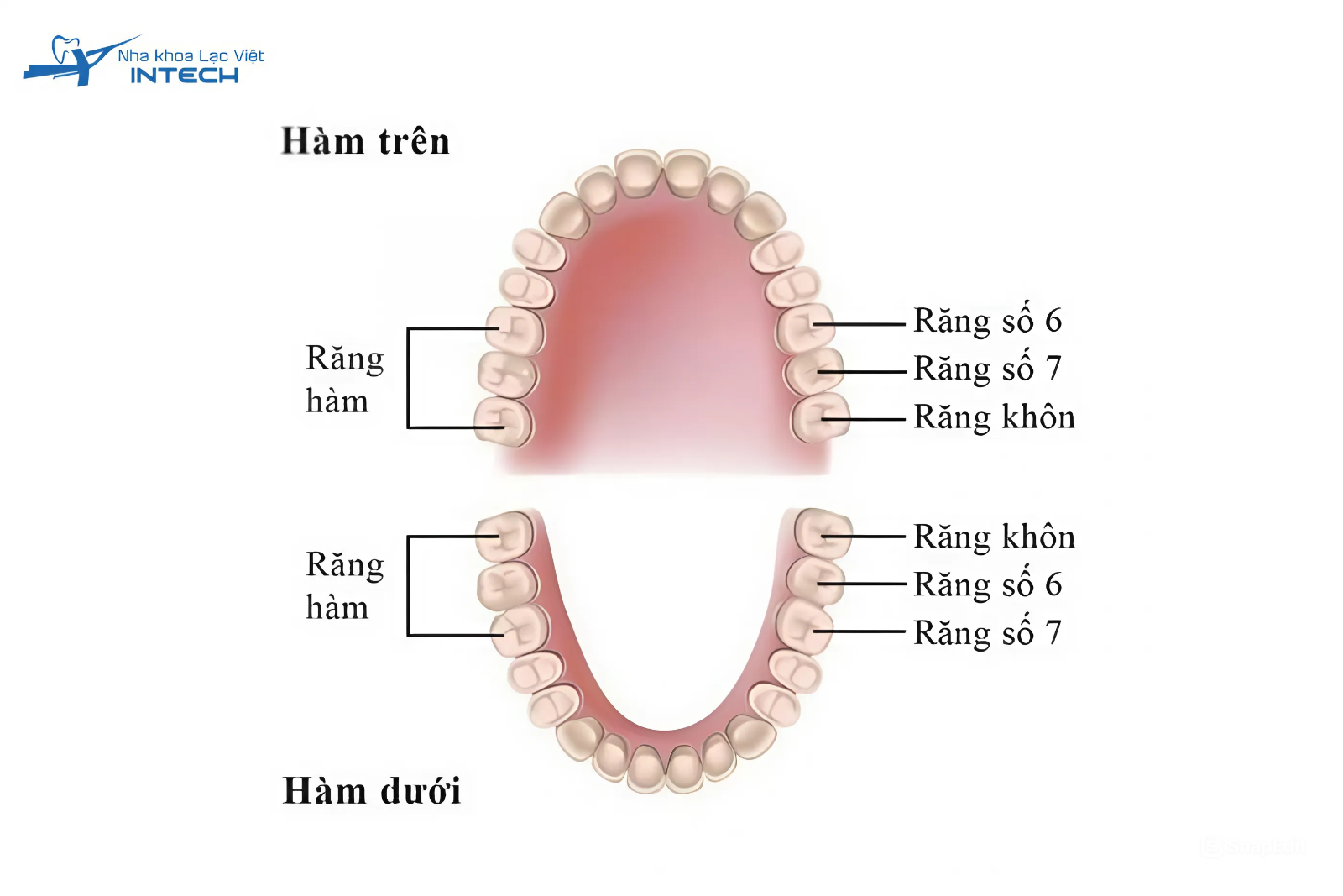 Răng số 6 là là răng hàm lớn thứ nhất nằm ở vị trí trung tâm của hàm nhưng thường rất khó để vệ sinh đúng cách
