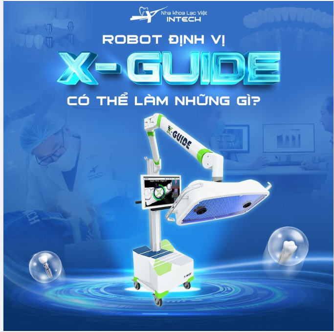 Robot định vị X-Guide giúp quá trình cấy ghép Implant chính xác và an toàn nhờ khả năng lập kế hoạch chi tiết, theo dõi trực quan và cảnh báo sai lệch trong suốt quá trình phẫu thuật