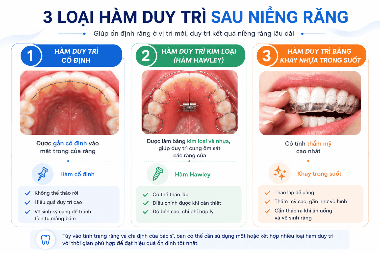 sự thật về niềng răng hàm duy trì