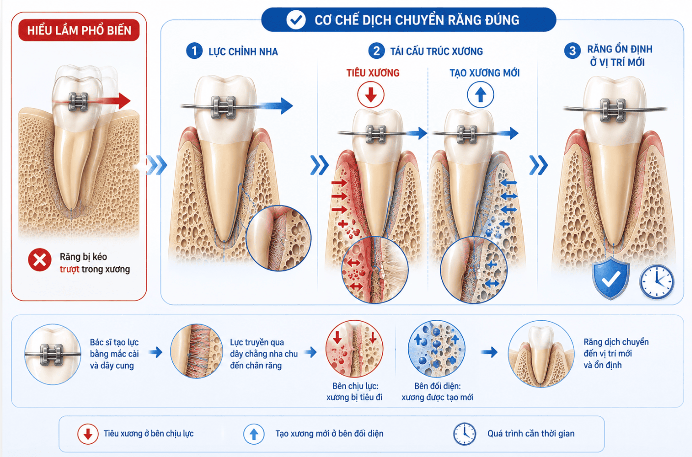 sự thật về niềng răng