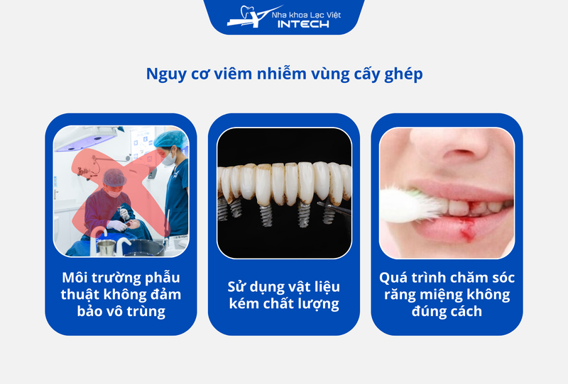 Nguyên nhân dẫn đến viêm nhiễm sau cấy ghép Implant