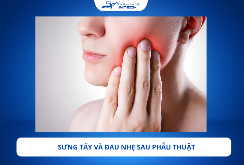 Sau khi đặt trụ Implant, cô chú/anh chị có thể cảm thấy đau nhẹ và sưng vùng phẫu thuật