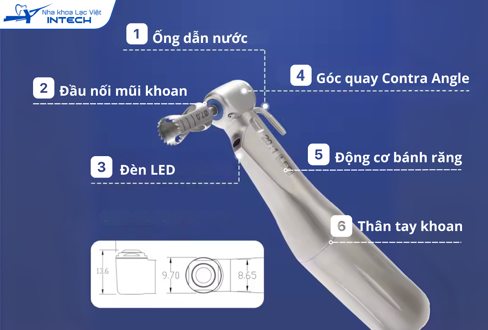 Tìm hiểu từ A - Z về tay cắm Implant được sử dụng trong trồng răng