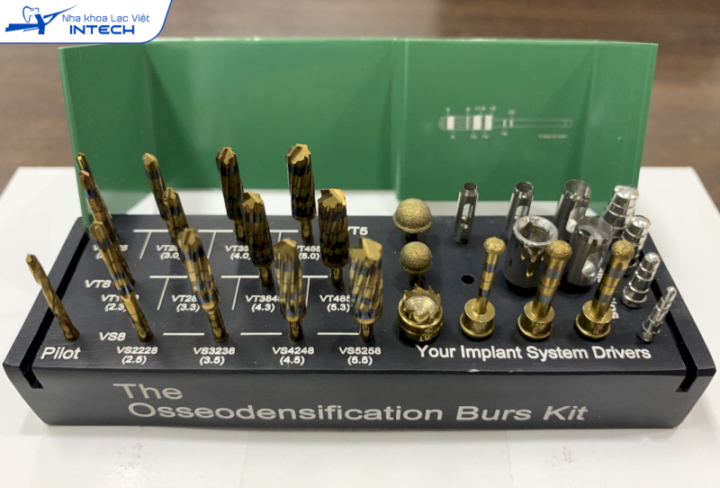 Bác sĩ sử dụng mũi khoan phù hợp để khoan tách xương trong quá trình tạo lỗ chờ đặt trụ Implant