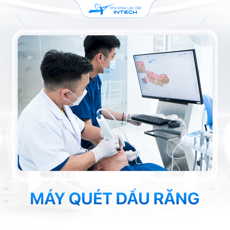 Máy scan hiện đại giúp lấy dấu răng nhanh chóng, chính xác, không gây khó chịu như phương pháp truyền thống