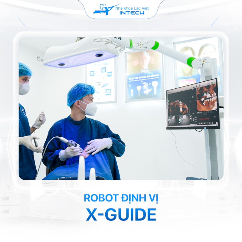 Robot định vị X-guide giúp xác định tọa độ đặt trụ Implant, giúp bác sĩ đặt trụ chính xác