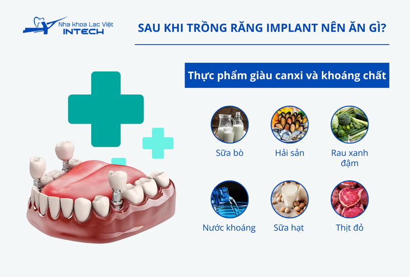 Thực phẩm giàu canxi và khoáng chất hỗ trợ quá trình tích hợp xương hàm của trụ Implant