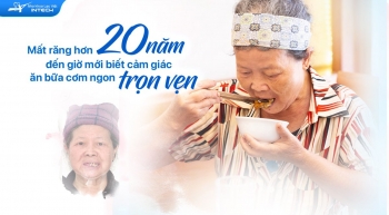 20 NĂM MẤT RĂNG VÀ NIỀM HẠNH PHÚC TRỌN VẸN SAU KHI TRỒNG RĂNG IMPLANT TOÀN HÀM