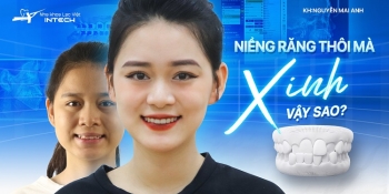 10X SỞ HỮU NHAN SẮC VẠN NGƯỜI MÊ NHỜ NIỀNG RĂNG