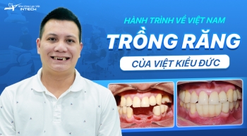 Hành trình về Việt Nam trồng răng Implant của Việt kiều Đức 