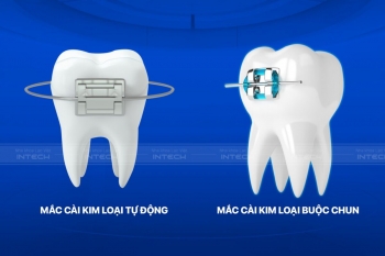 Mắc cài tự động và mắc cài buộc chun có cấu tạo và chức năng gì?