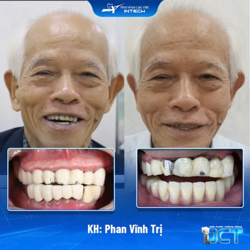 KH: Phan Vĩnh Trị