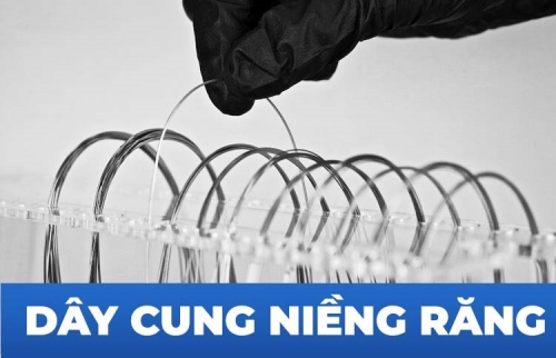 Những bí mật về dây cung niềng răng có thể bạn chưa biết!